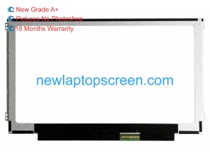Lenovo chromebook n21-80mg 11.6 inch laptop scherm