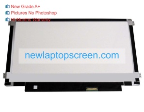 Lenovo chromebook 100s 11iby 11.6 inch portátil pantallas
